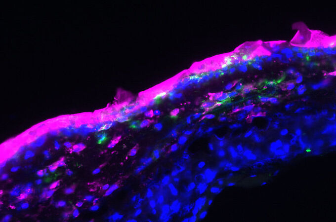 Fluoreszenzmikroskopie: Die Aptamere (hier pink markiert) wurden in Form einer Salbe auf die oberste Hautschicht aufgetragen und drangen auch in tiefere Hautschichten ein (Zellkerne: blau; Antigen-präsentierende Zellen: grün). | Copyright: Bild: Marlene Gottschalk 
