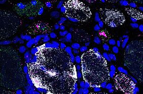 Die Fluoreszenzaufnahme zeigt den DNA-Schädigungsmarker GADD45A (magenta) in verschiedenen Muskelfasertypen (Typ-1-Muskelfaser = grün, Typ-2A-Muskelfaser = weiß). Zellkerne sind blau dargestellt. | Copyright: UMM 