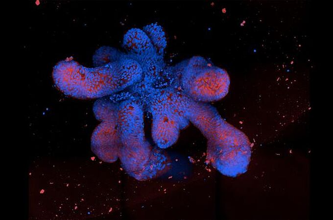 Immunofluoreszenz-Aufnahme eines Darm-Organoids. Credits: Thomas Dennison/University of Cambridge