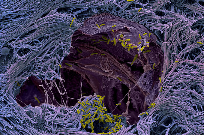 Der Krankenhauskeim Pseudomonas aeruginosa durchbricht die Abwehrlinie des Lungengewebes (Aufnahme im menschlichen Gewebemodell, vom Rasterelektronenmikroskop). | Quelle: Benoit Laventie | Copyright: Biozentrum, Universität Basel |