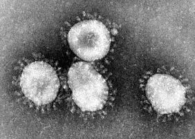 Humanes Coronavirus 229E aus dem Jahr 1975. Credits: CDC/Dr. Fred Murphy 