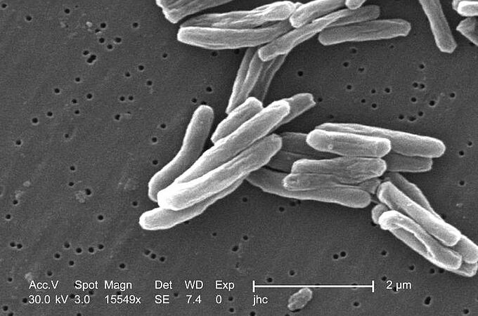 Elektronenmikroskop-Aufnahme von Mycobacterium tuberculosis. Credits: CDC