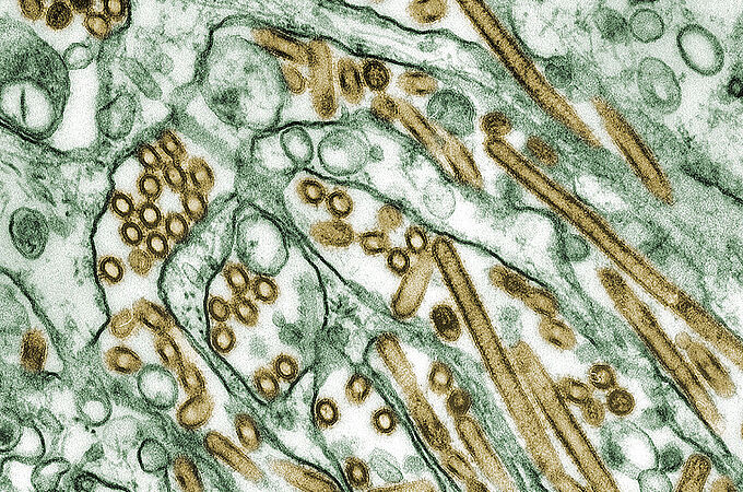 Transmissionselektronenmikroskopie von H5N1-Viren (in Gold) des aviären Influenzavirus, die in MDCK-Zellen (in Grün) gezüchtet wurden.. Credits: CDC/ Courtesy of Cynthia Goldsmith; Jacqueline Katz; Sherif R. Zaki