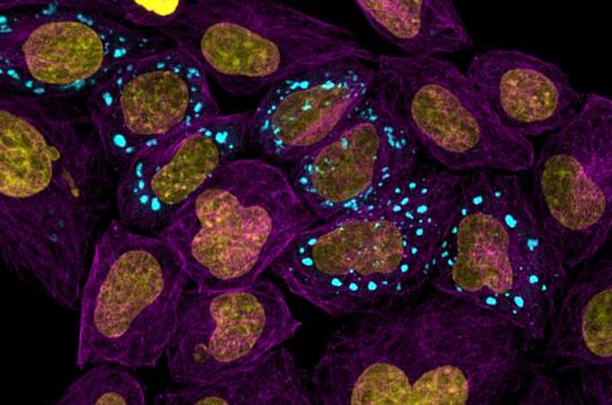 Mikrotubuli, die den Zellkörper (violett) mit Zellkern (gelb) und Kondensaten (blau) hervorheben. Credits: Andrew Seeber
