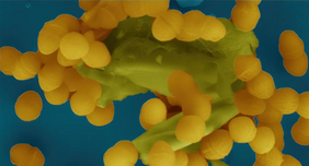 Das Bild eines Elektronenmikroskops zeigt, wie Enterococcus faecalis-Bakterien verklumpen, um unter anderem ihre Antibiotikaresistenz miteinander zu teilen. Credits: Josy ter Beek