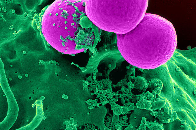 Ein neuartiger präventiver Wirkstoff gegen multiresistente Bakterien soll deren Besiedlung in der Nase bekämpfen. Das Unternehmen HYpharm hat in den vergangenen Jahren gemeinsam mit universitären Partnern und unterstützt durch das Deutsche Zentrum für Infektionsforschung (DZIF) den Wirkstoff HY-133 weiterentwickelt und untersucht. Credits: NIH