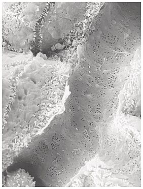Aufnahme eines kleinen Blutgefäßes der Leber mit den Fenstern (kleine, dunkelgraue Punkte) | Copyright: HHU / Sydney Balkenhol 
