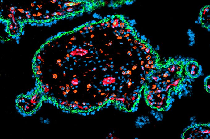 Plazentazotte: Umrandet ist sie von grünen Trophoblasten – das sind die äußeren Zellschichten der Keimblase, die am vierten Tag nach der Befruchtung aus der mehrfach geteilten Eizelle entsteht. Die fetalen Gefäße sind rot, die Hofbauerzellen orange.  Copyright: Max Delbrück Center