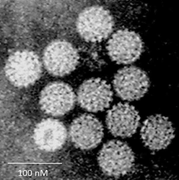 csm_Papilloma_Virus__HPV__EM__new_version__1865264ce3.jpg